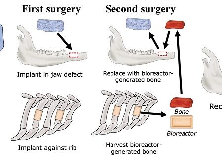 Siberian Scientists Develop Bone Implants from Food Waste