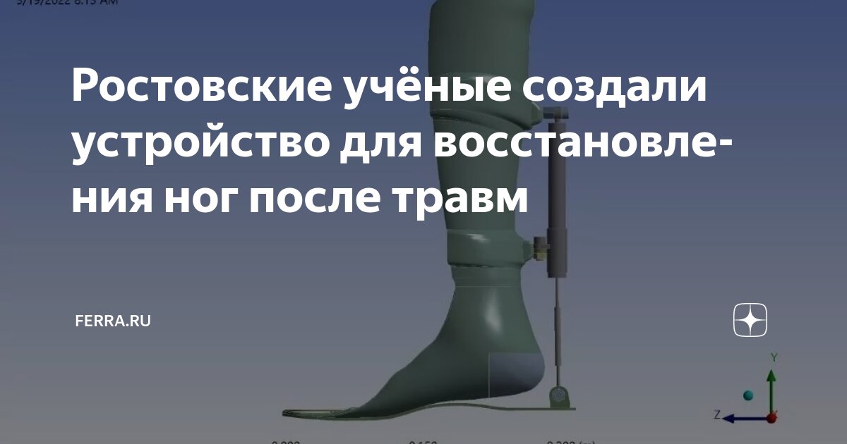 Preview Rostov Scientists Create Device Preventing Leg Amputation