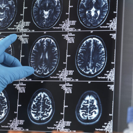 Russian Scientists Identify New Health Risks for Drivers