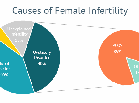 Method Found to Predict Disease Leading to Infertility