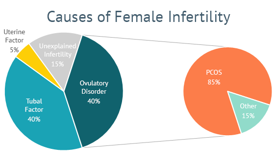 Preview Method Found to Predict Disease Leading to Infertility