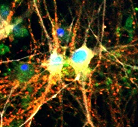 Scientists Discover Crucial Protein in Fly Brain for Combating Disease