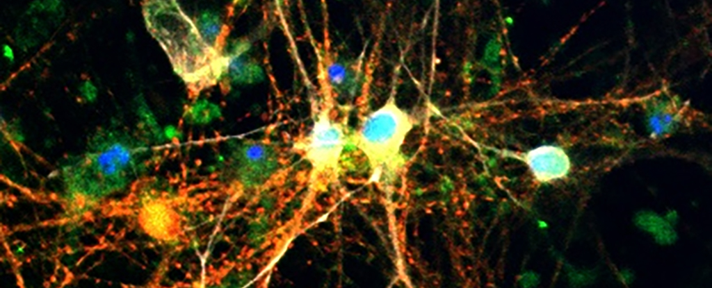 Preview Scientists Discover Crucial Protein in Fly Brain for Combating Disease