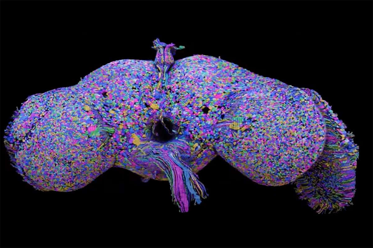 Preview Enhanced Vein Visualization: Samara Scientists Unveil New Algorithm