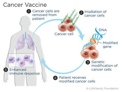 Preview Personalized Melanoma Vaccine Set to Become Available to Patients in Coming Months