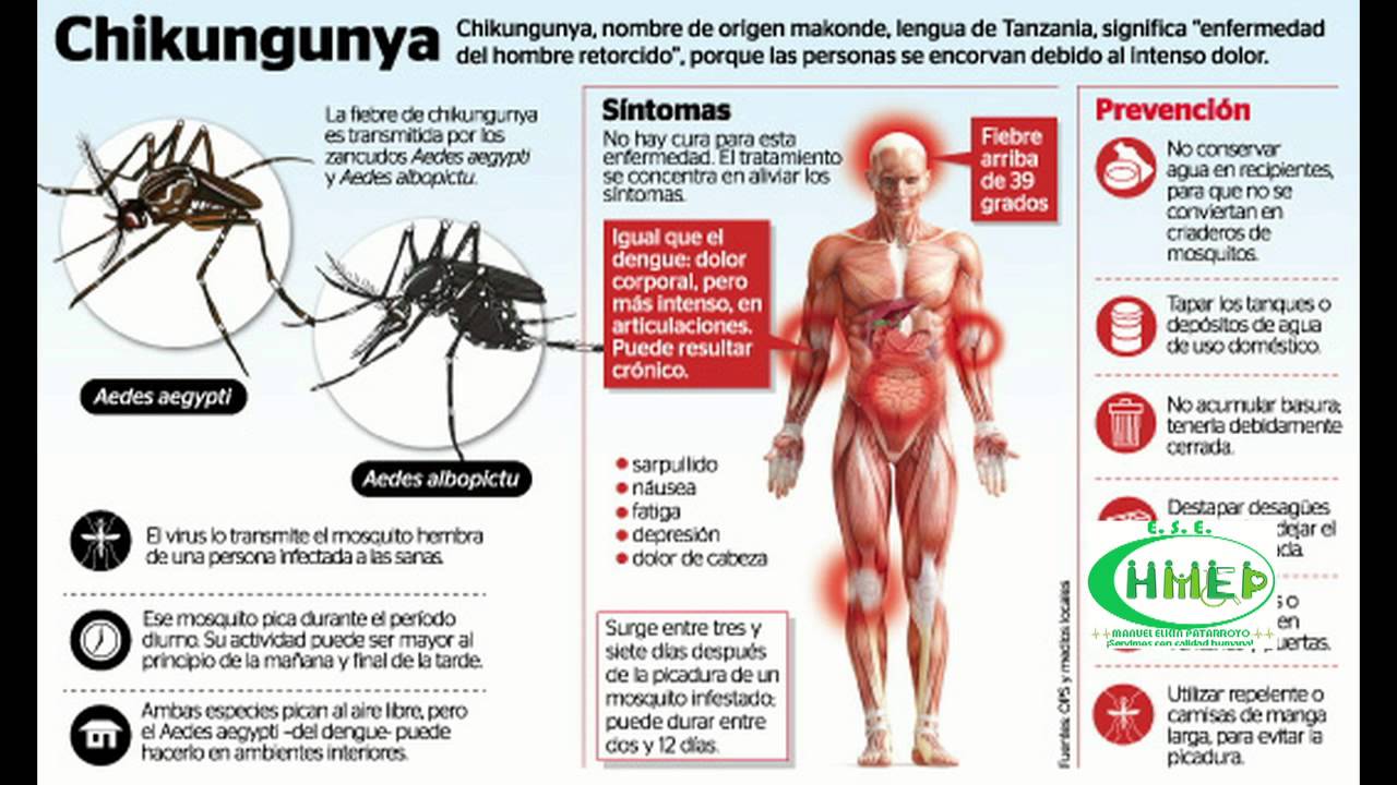 Preview Can Russians Contract Chikungunya Fever?