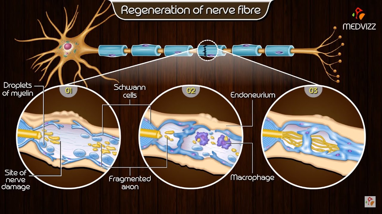 Preview Russia Develops ‘Soft’ Material for Nerve Regeneration