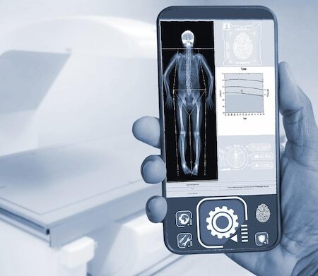 Development of a Smartphone-Sized X-ray Device in Belgorod