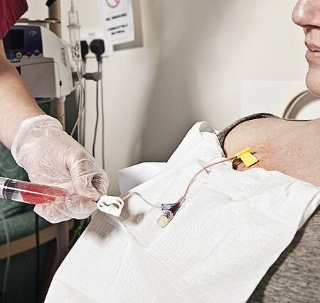 Russian Scientists Develop Implant for Post-Chemotherapy Blood Restoration